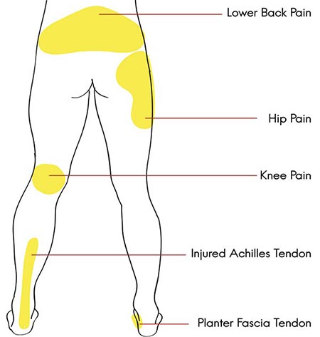 Illustration of trigger point of legs and lower back pain for runners